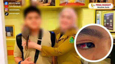 Terbaru! Dugaan Bullying Siswa Alexandria Boarding School Bekasi, Mata Korban Alami Pecah Pembuluh Darah