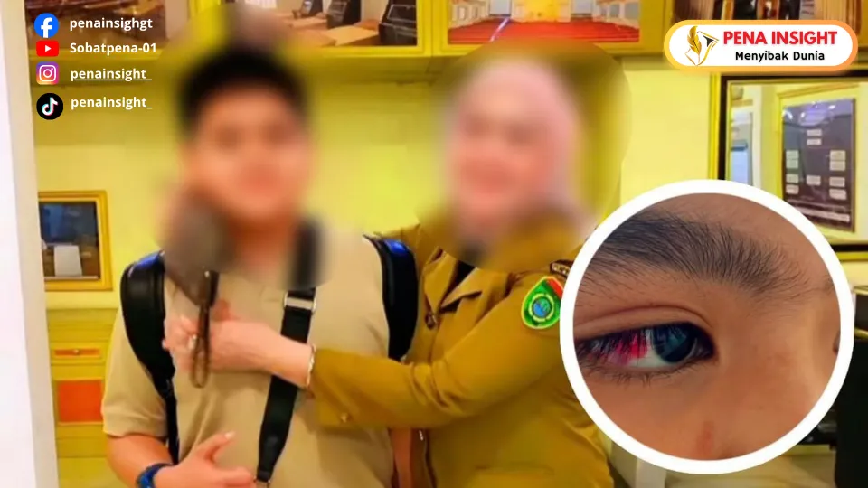 Terbaru! Dugaan Bullying Siswa Alexandria Boarding School Bekasi, Mata Korban Alami Pecah Pembuluh Darah